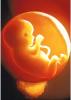 Foetus